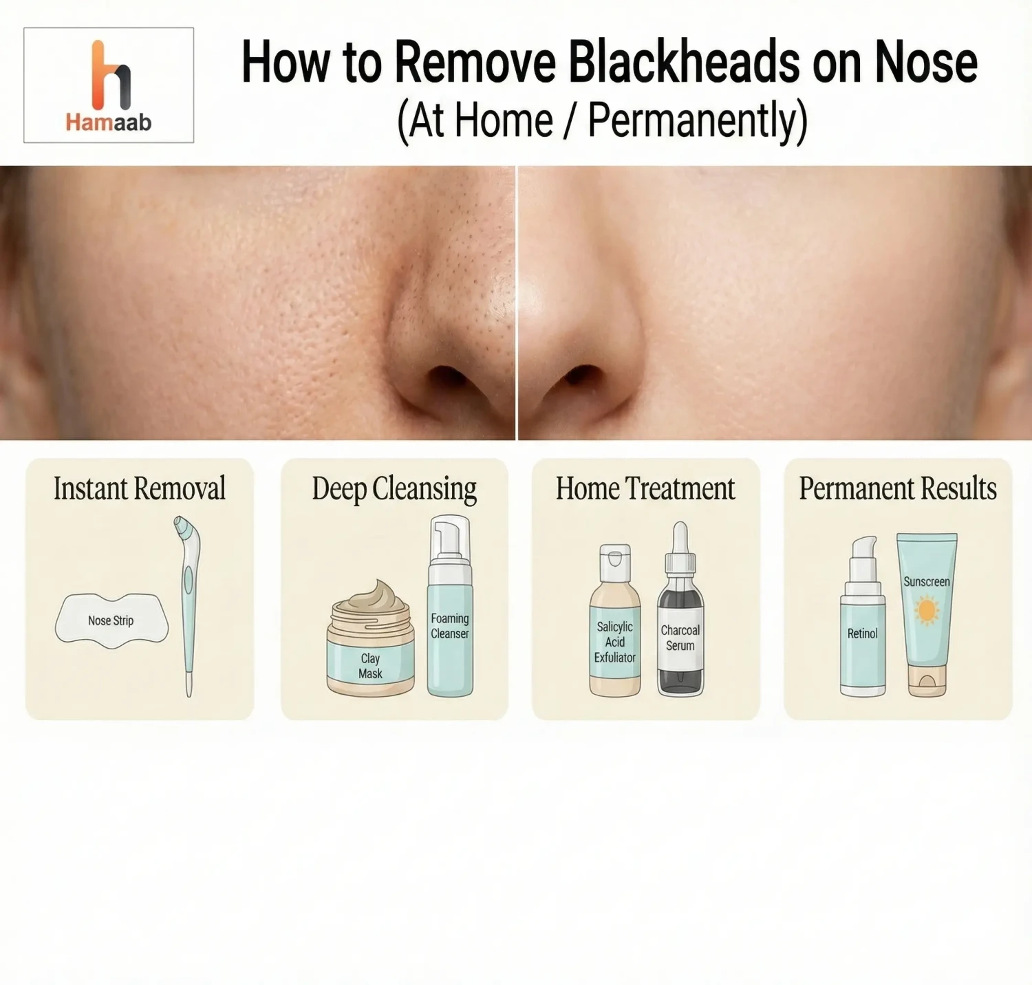 How to Remove Blackheads on Nose (At Home / Permanently)